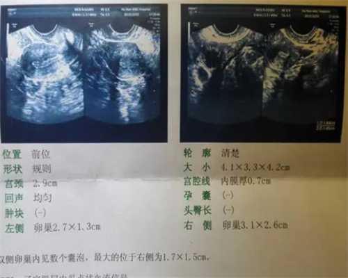 2023河北省试管婴儿医院排名,河北省生殖